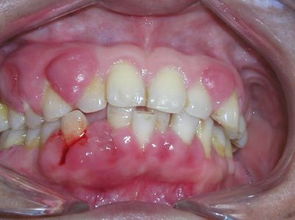 猫牙龈红肿口臭怎么治疗-猫牙龈发红而且口腔有异味